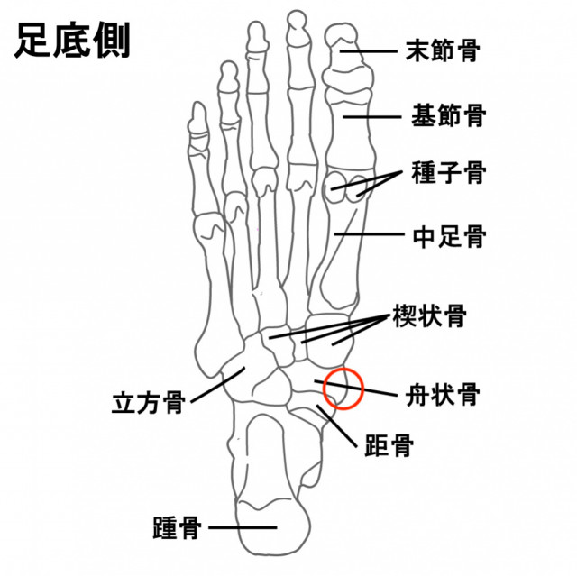 有痛性外脛骨が起こる部分