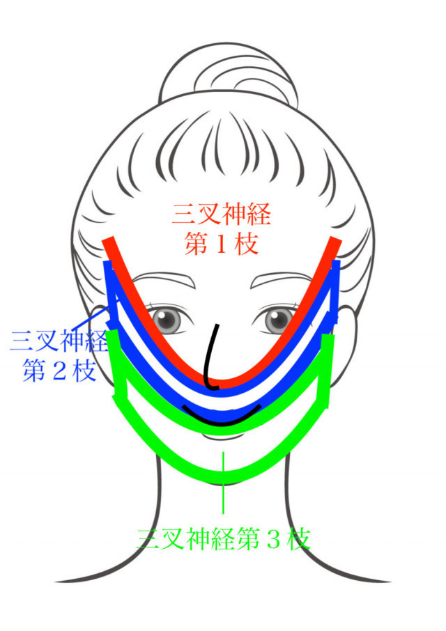 三叉神経痛とは